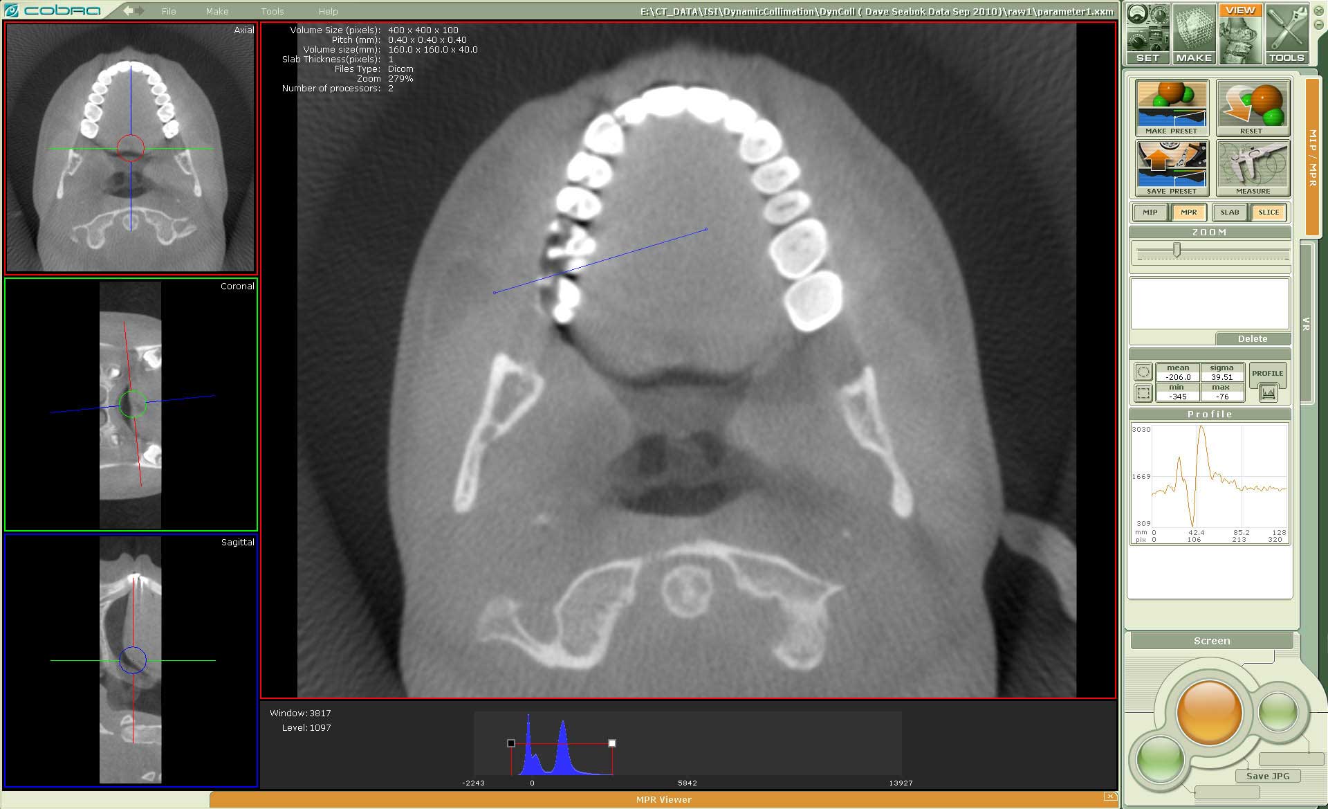 Free dicom viewer with cd burning